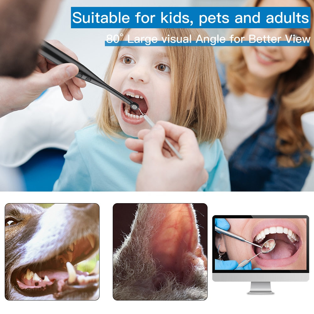 Intraoral Dental Camera Endoscope 720P HD Oral Dental Camera